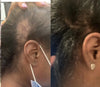 Natural Hair Growth Elixir